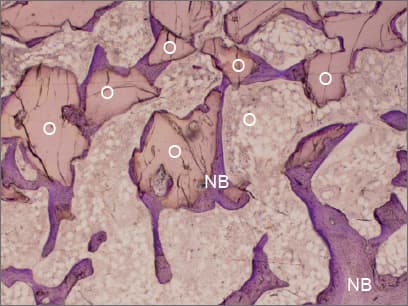 Histology — 3 months after implantation