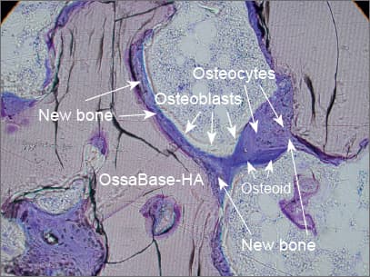 Histology — osteoconduction in detail